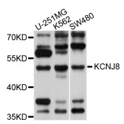 Western blot analysis of extracts of various cell lines, using KCNJ8 antibody (abx126036) at 1/1000 dilution.