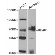 Western blot analysis of extracts of various cell lines, using KEAP1 antibody (abx126050) at 1/1000 dilution.