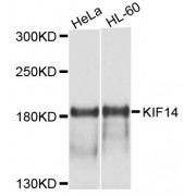 Western blot analysis of extracts of various cell lines, using KIF14 antibody (abx126054) at 1/1000 dilution.
