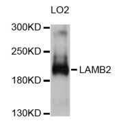 Western blot analysis of extracts of LO2 cells, using LAMB2 antibody (abx126074) at 1/1000 dilution.