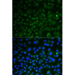 Lysosomal Associated Membrane Protein 1 (LAMP1) Antibody