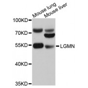 Western blot analysis of extracts of various cell lines, using LGMN antibody (abx126093) at 1/1000 dilution.
