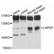 Western blot analysis of extracts of various cell lines, using LNPEP antibody (abx126101) at 1:3000 dilution.