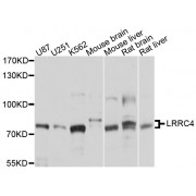 Western blot analysis of extracts of various cell lines, using LRRC4 antibody (abx126105) at 1/1000 dilution.