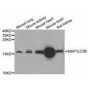 Western blot analysis of extracts of various cell lines, using MAP1LC3B antibody (abx126116) at 1/1000 dilution.