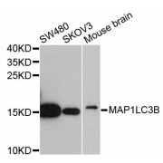 Western blot analysis of extracts of various cell lines, using MAP1LC3B antibody (abx126117) at 1/1000 dilution.
