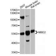 Western blot analysis of extracts of various cell lines, using MBD2 antibody (abx126133) at 1:3000 dilution.