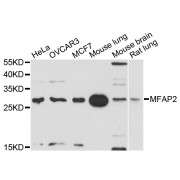 Western blot analysis of extracts of various cell lines, using MFAP2 antibody (abx126151) at 1/1000 dilution.