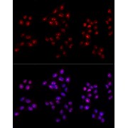 Immunofluorescence analysis of HeLa cells using MKI67 antibody (1/100 dilution, 40x lens). Blue: DAPI for nuclear staining.