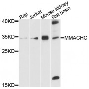 Western blot analysis of extracts of various cell lines, using MMACHC antibody (abx126165) at 1/1000 dilution.