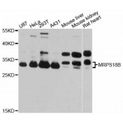 Western blot analysis of extracts of various cell lines, using MRPS18B antibody (abx126187) at 1:3000 dilution.