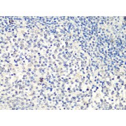 Immunohistochemistry of paraffin-embedded human tonsil using MTA2 Antibody (abx126193) at dilution of 1/100 (40x lens).