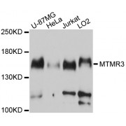 Western blot analysis of extracts of various cell lines, using MTMR3 antibody (abx126196) at 1/1000 dilution.