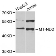 Western blot analysis of extracts of various cell lines, using MT-ND2 antibody (abx126197) at 1/1000 dilution.