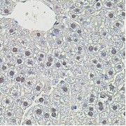 Immunohistochemistry of paraffin-embedded mouse liver using MYC antibody (abx126207) at dilution of 1/100 (40x lens).