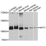Western blot analysis of extracts of various cell lines, using MYT1 antibody (abx126212) at 1/1000 dilution.