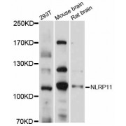Western blot analysis of extracts of various cell lines, using NLRP11 antibody (abx126256) at 1/1000 dilution.