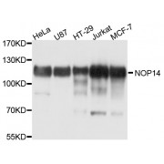 Western blot analysis of extracts of various cell lines, using NOP14 antibody (abx126263) at 1/1000 dilution.