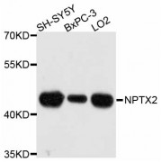 Western blot analysis of extracts of various cell lines, using NPTX2 antibody (abx126271) at 1:3000 dilution.