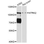 Western blot analysis of extracts of various cell lines, using NTRK2 Antibody (abx126280) at 1:3000 dilution.