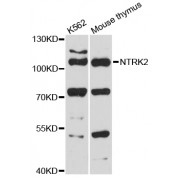 Western blot analysis of extracts of various cell lines, using NTRK2 antibody (abx126281) at 1:3000 dilution.