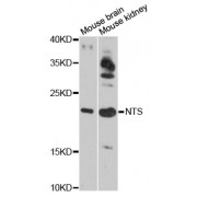 Western blot analysis of extracts of various cell lines, using NTS antibody (abx126283) at 1:3000 dilution.