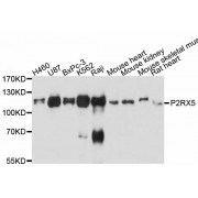 Western blot analysis of extracts of various cell lines, using P2RX5 antibody (abx126306) at 1:3000 dilution.