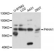 Western blot analysis of extracts of various cell lines, using P4HA1 antibody (abx126309) at 1/1000 dilution.