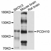 Western blot analysis of extracts of various cell lines, using PCDH10 antibody (abx126330) at 1:3000 dilution.