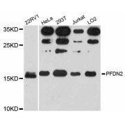 Western blot analysis of extracts of various cell lines, using PFDN2 antibody (abx126352) at 1:3000 dilution.