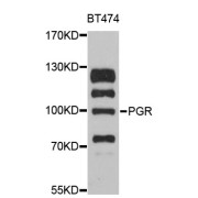 Western blot analysis of extracts of BT-474 cells, using PGR antibody (abx126356) at 1:3000 dilution.