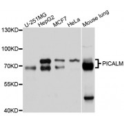 Western blot analysis of extracts of various cell lines, using PICALM antibody (abx126359) at 1/1000 dilution.
