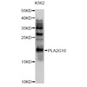 Western blot analysis of extracts of K562 cells, using PLA2G10 antibody (abx126373) at 1/1000 dilution.