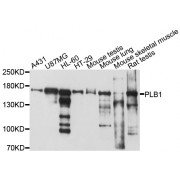 Western blot analysis of extracts of various cell lines, using PLB1 antibody (abx126374) at 1/1000 dilution.