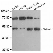 Western blot analysis of extracts of various cell lines, using PNMAL1 antibody (abx126379) at 1:3000 dilution.