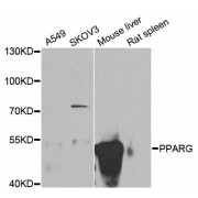 Western blot analysis of extracts of various cell lines, using PPARG antibody (abx126397) at 1/1000 dilution.