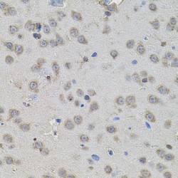 Peroxisome Proliferator Activated Receptor Gamma (PPARG) Antibody