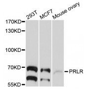 Western blot analysis of extracts of various cell lines, using PRLR antibody (abx126414) at 1/1000 dilution.