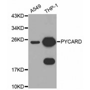 Western blot analysis of extracts of various cell lines, using PYCARD antibody (abx126441) at 1/1000 dilution.