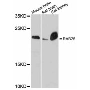 Western blot analysis of extracts of various cell lines, using RAB25 antibody (abx126445) at 1:3000 dilution.