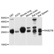 Western blot analysis of extracts of various cell lines, using RAB27B antibody (abx126446) at 1/1000 dilution.