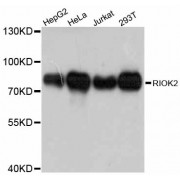 Western blot analysis of extracts of various cell lines, using RIOK2 antibody (abx126482) at 1:3000 dilution.