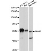 Western blot analysis of extracts of various cell lines, using RNMT antibody (abx126490) at 1:3000 dilution.
