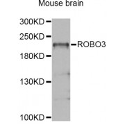Western blot analysis of extracts of various cell lines, using ROBO3 Antibody (abx126491) at 1/1000 dilution.