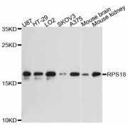 Western blot analysis of extracts of various cell lines, using RPS18 antibody (abx126495) at 1:3000 dilution.