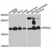 Western blot analysis of extracts of various cell lines, using RPS24 antibody (abx126497) at 1:3000 dilution.