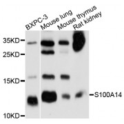 Western blot analysis of extracts of various cell lines, using S100A14 antibody (abx126505) at 1/1000 dilution.