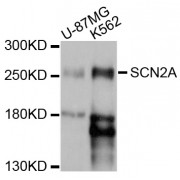 Western blot analysis of extracts of various cell lines, using SCN2A antibody (abx126513) at 1/1000 dilution.