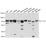 Western blot analysis of extracts of various cell lines, using SLC11A2 antibody (abx126556) at 1/1000 dilution.