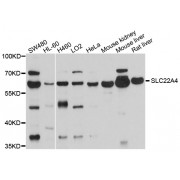Western blot analysis of extracts of various cell lines, using SLC22A4 antibody (abx126564) at 1/1000 dilution.